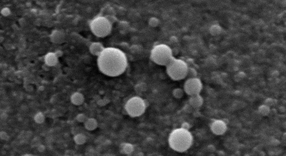 Sphéroplexes : nanoparticules hybrides lipide/polymère